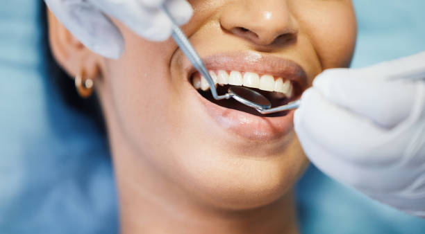 Best Emergency Wisdom Teeth Removal in Orland Hls, IL