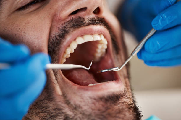 Best Emergency Dental Care for Trauma or Injury in Orland Hls, IL
