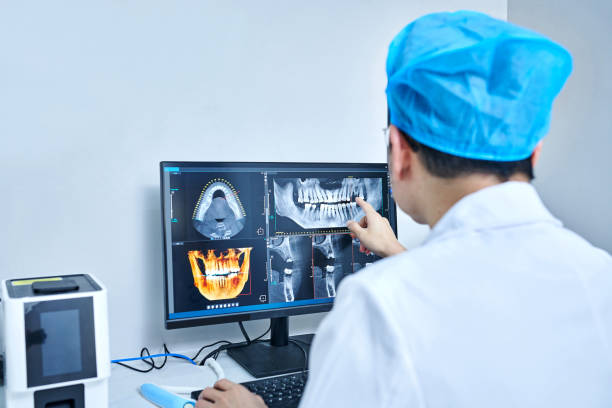Best Emergency Wisdom Teeth Removal in Orland Hls, IL