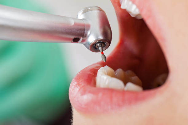 Best Same-Day Emergency Dentist in Orland Hls, IL